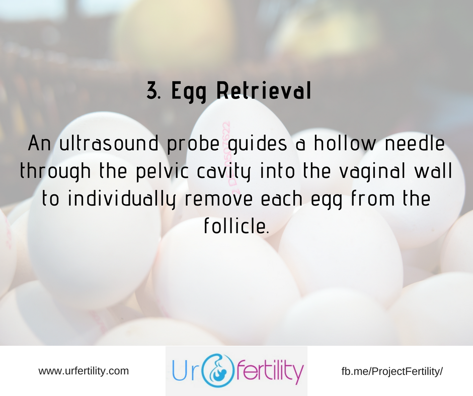 IVF treatment Egg Retrieval