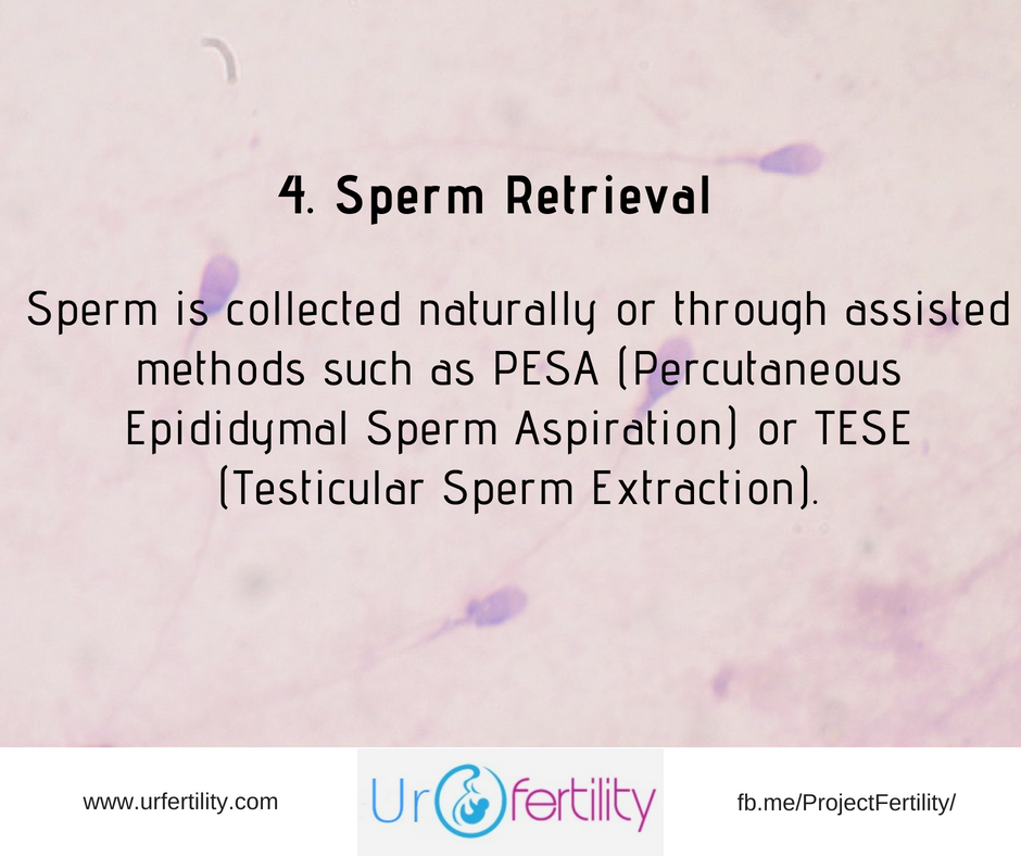 IVF treatment Sperm Retrieval