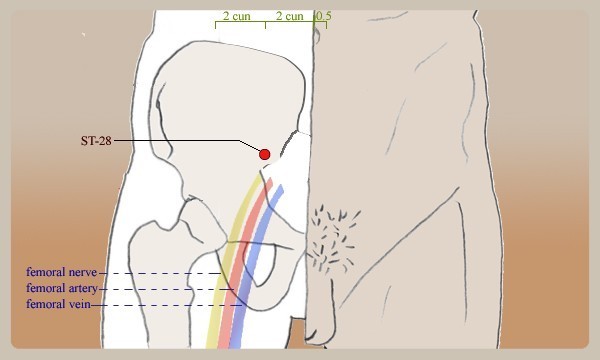 ST-28 Acupuncture PCOS