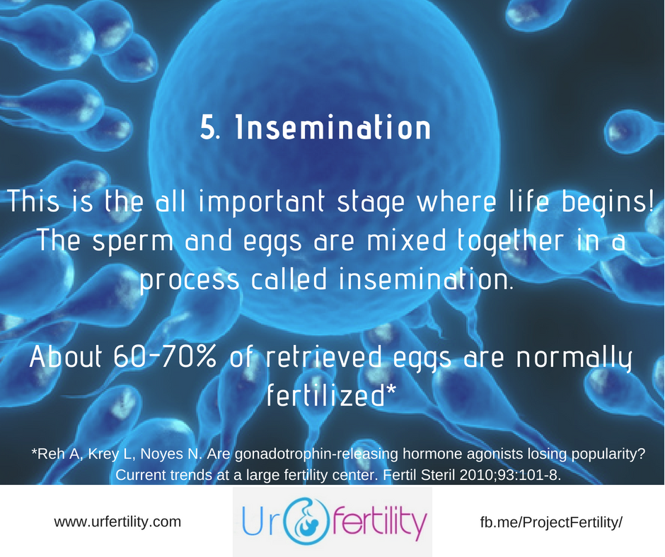 IVF treatment Insemination